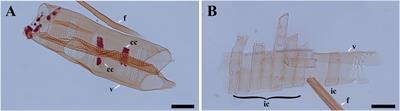 Positional differences in the micro- and ultra-structural variations of ray parenchyma cells during the transformation from sapwood to heartwood